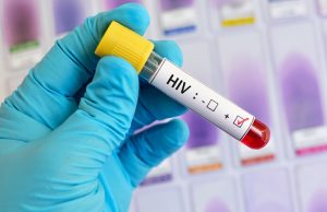 AIDS e Câncer